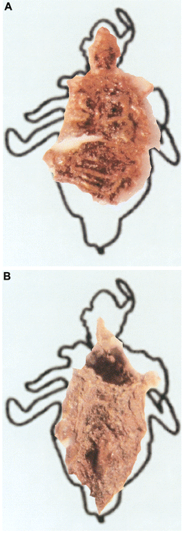 Identification of human body lice. (Raoult et al, 2006)